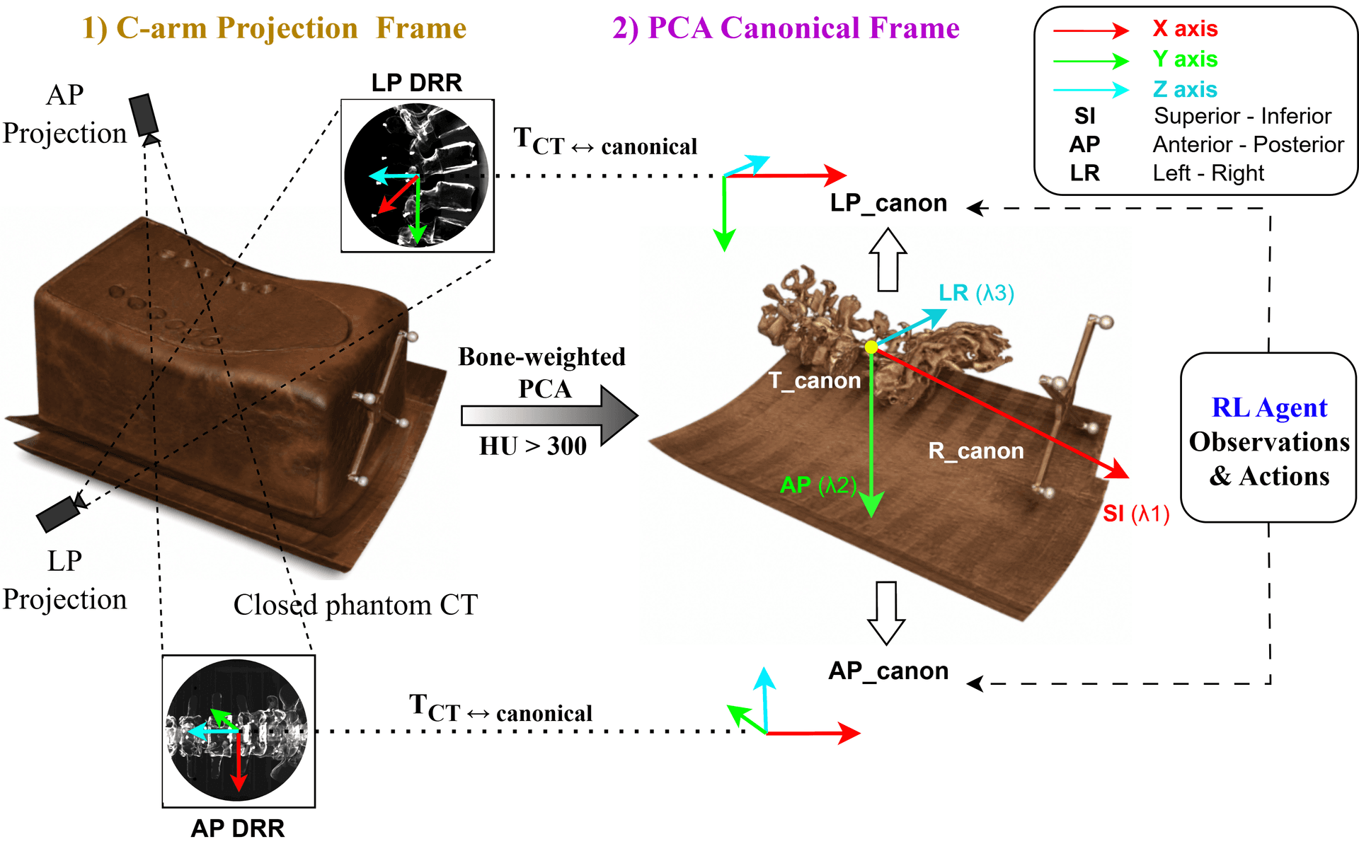 PCA-based canonical coordinate system derived from the principal axes of the vertebral bone voxels.