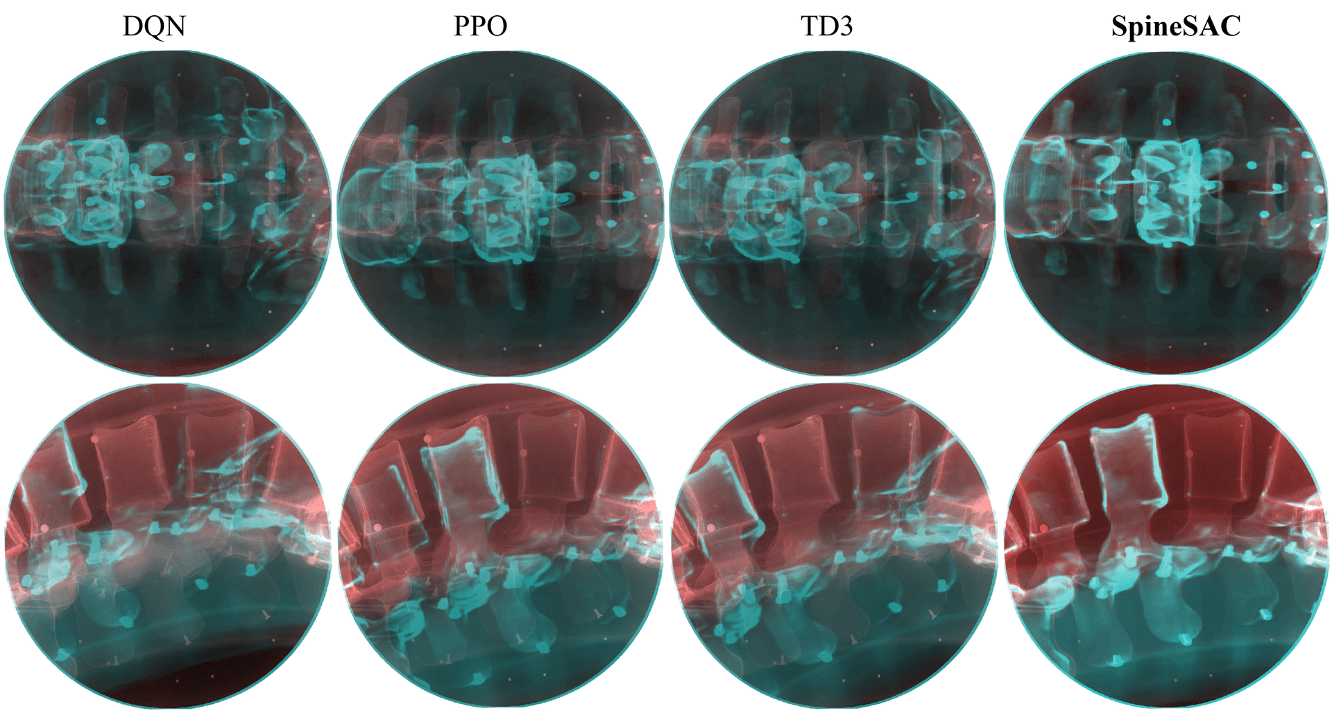 Blend view comparison of SpineSAC and baseline methods.